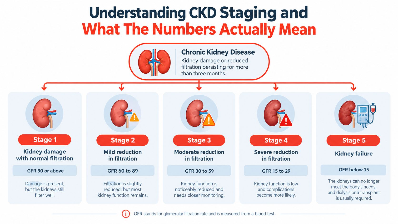 A chart explaining the five stages of chronic kidney disease based on GFR filtration levels.