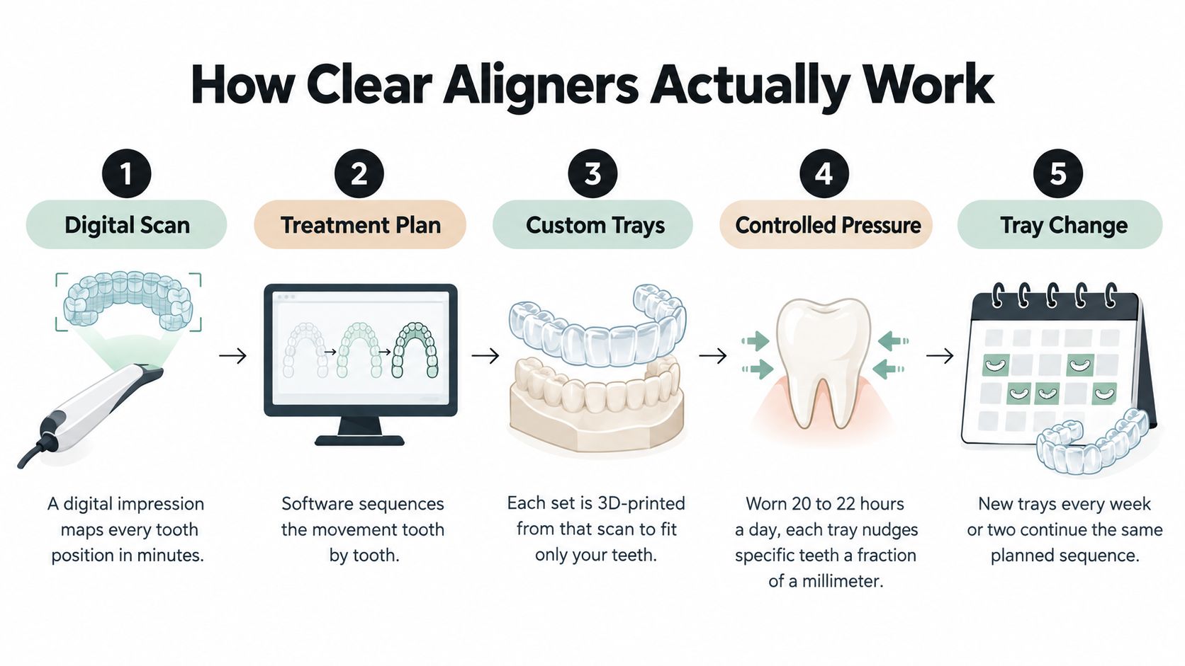 A step-by-step infographic illustrating the clear aligner teeth straightening process from digital scan to final treatment.