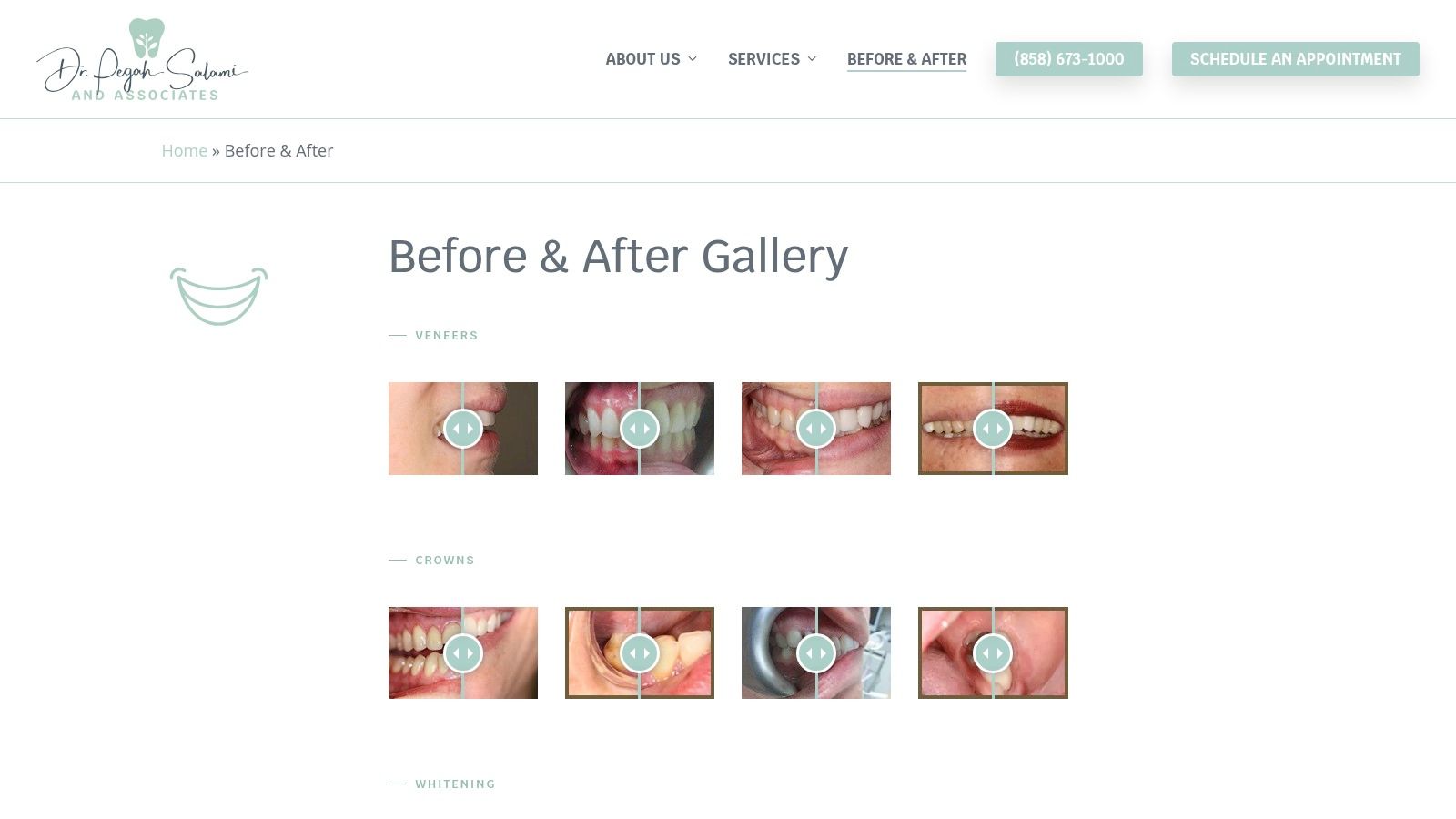 Before & After Gallery – Dr. Pegah Salami, DMD
