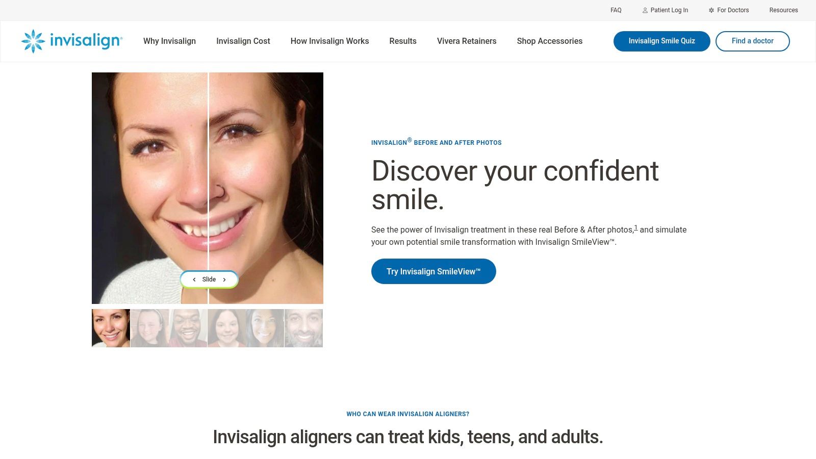Invisalign — Official Before & After Photos