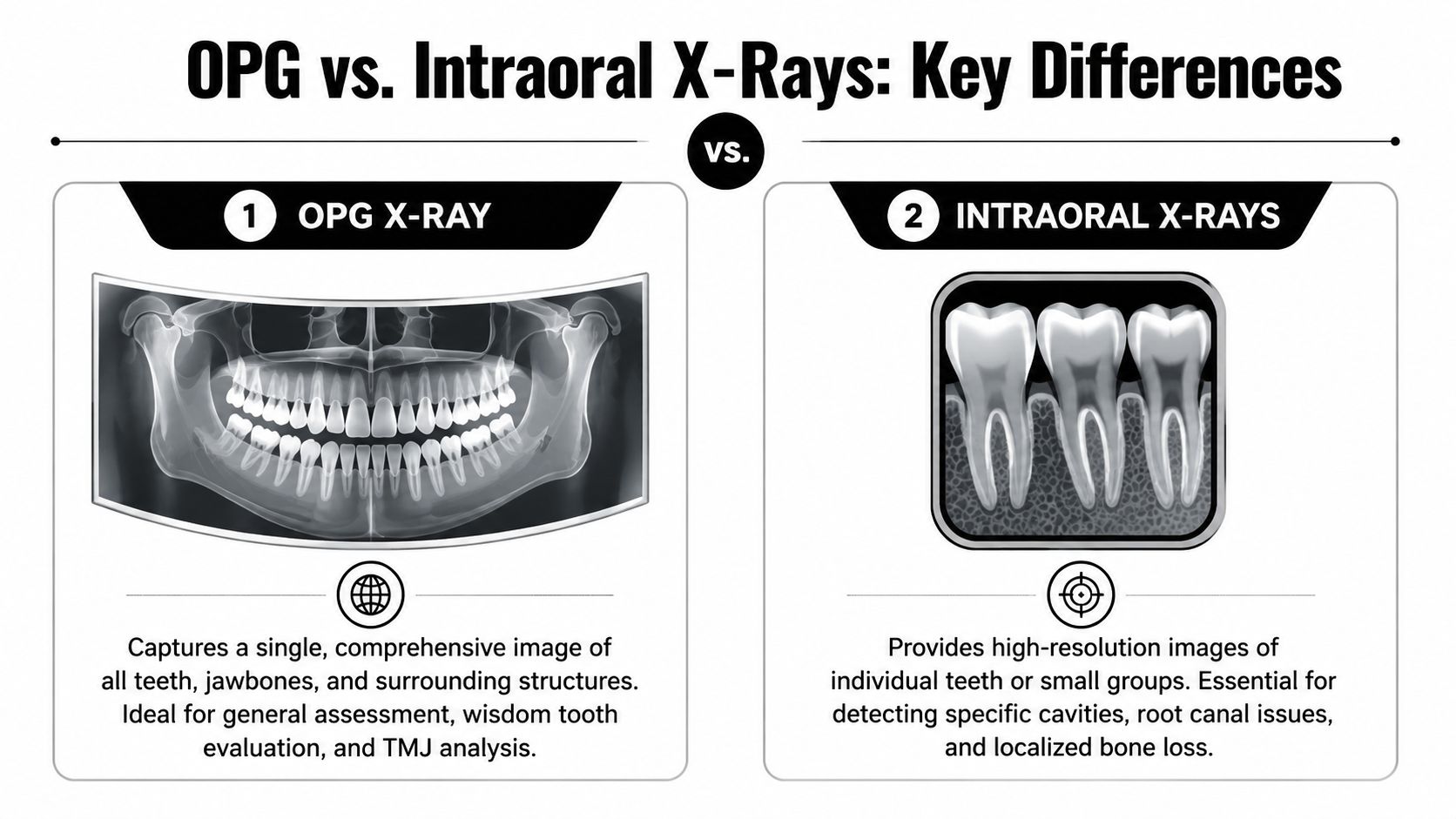 A comparative chart illustrating the differences between OPG X-rays and intraoral X-rays for dental diagnostics.