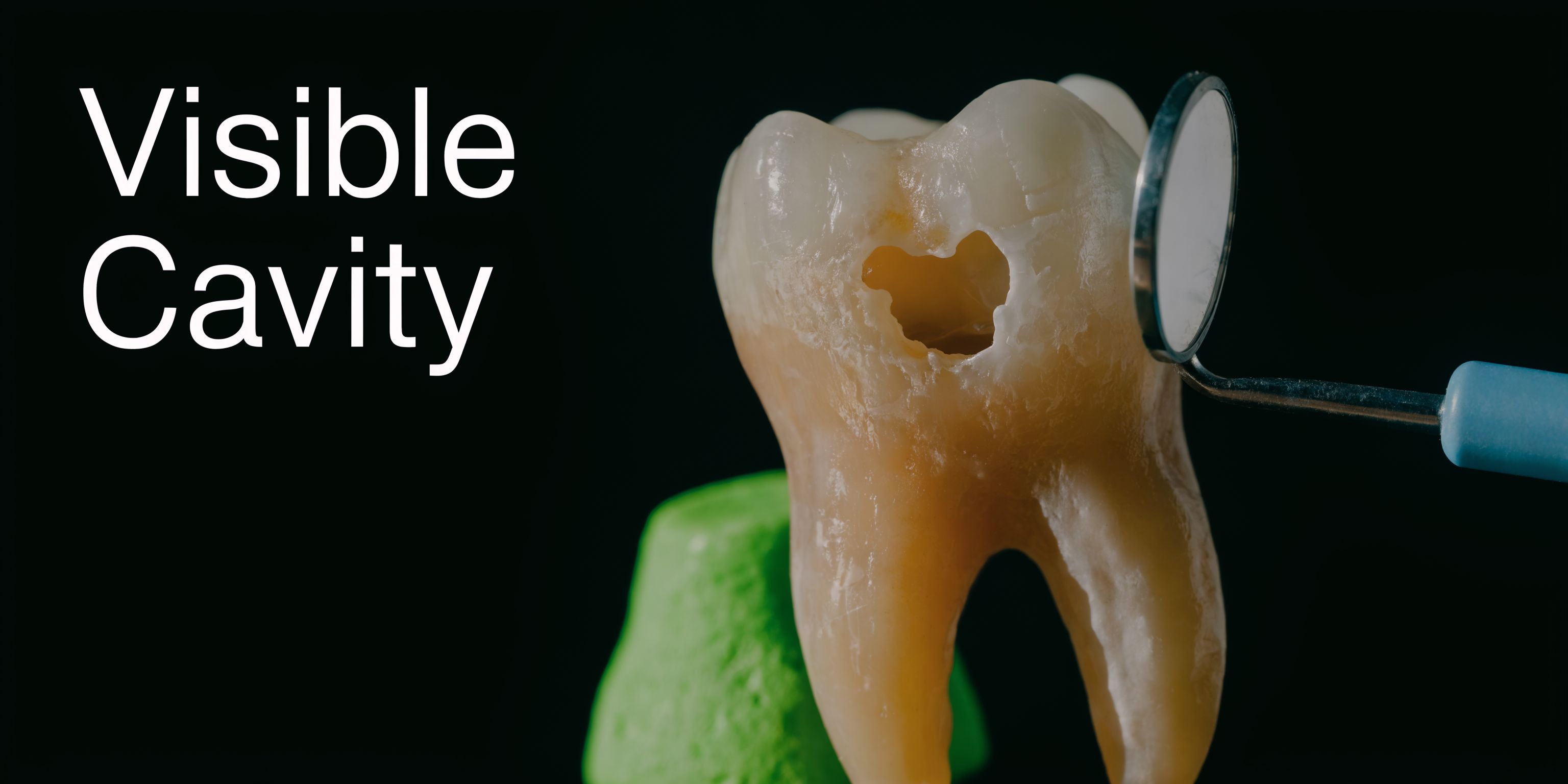 A close-up view of a model tooth showing a visible cavity being examined by a small dental mirror.