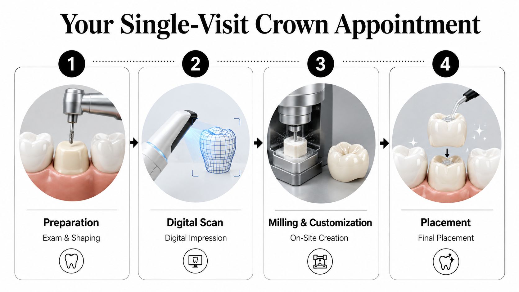 A four-step infographic illustrating the dental process for creating and placing a same-day ceramic tooth crown.