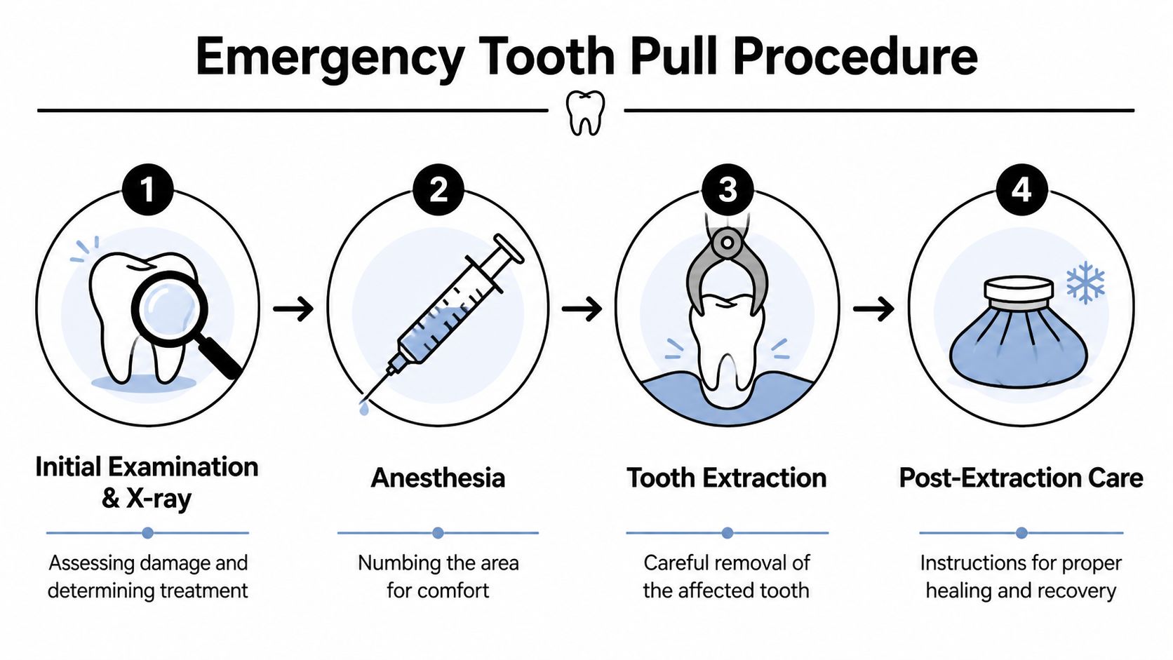 A four-step infographic illustrating the emergency tooth extraction procedure from examination to post-extraction care.