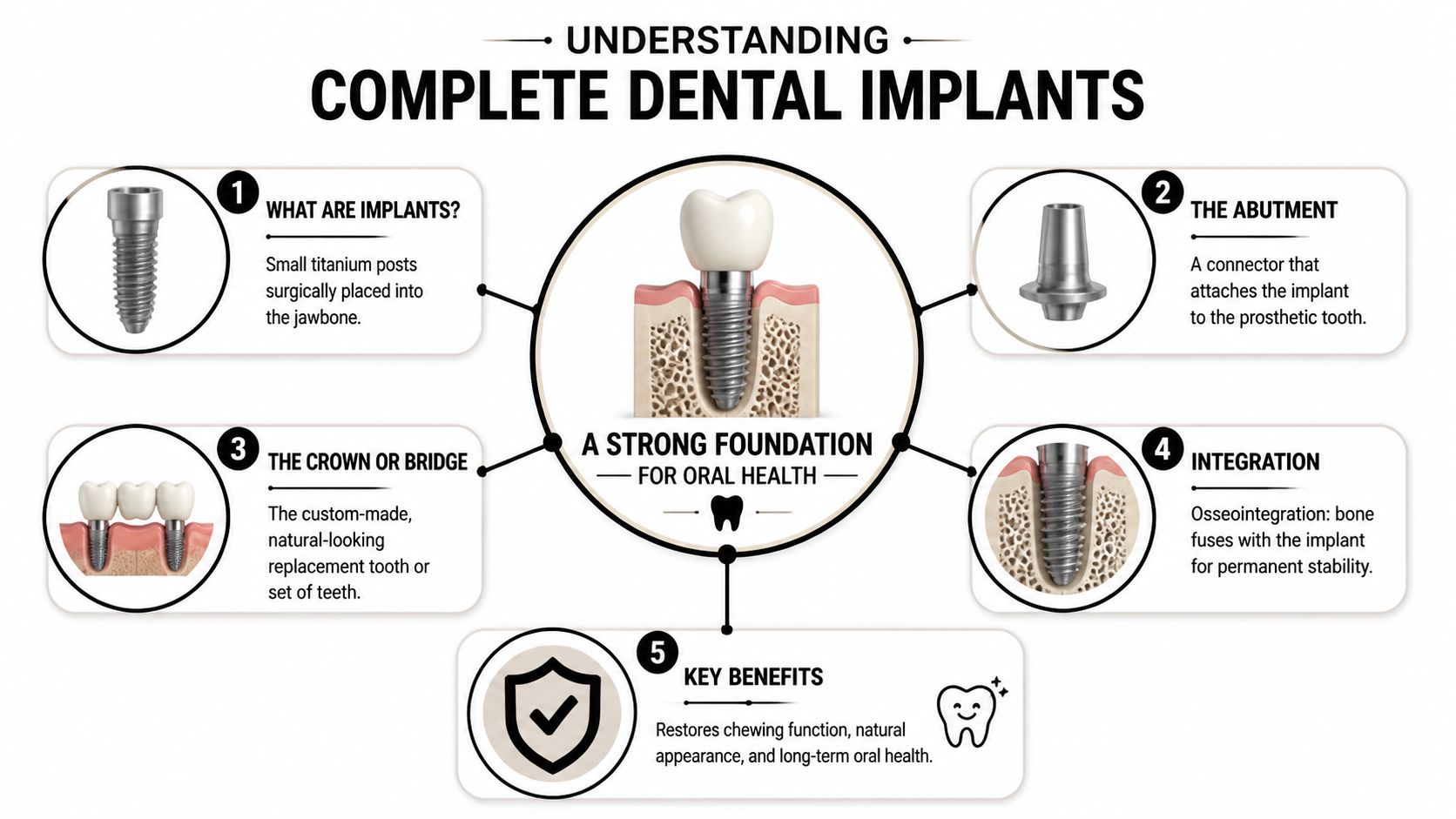 A diagram illustrating the components and benefits of a complete dental implant system for tooth replacement.