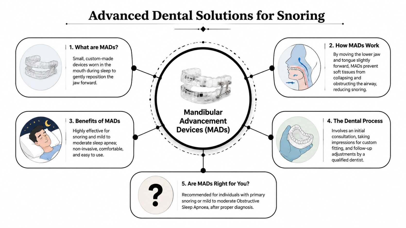 An infographic explaining how Mandibular Advancement Devices help reduce snoring and treat mild sleep apnea.