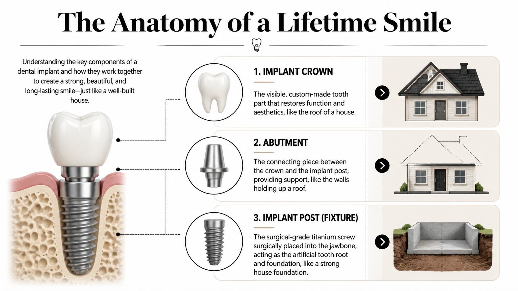 A diagram comparing the components of a dental implant to the structure of a house foundation.