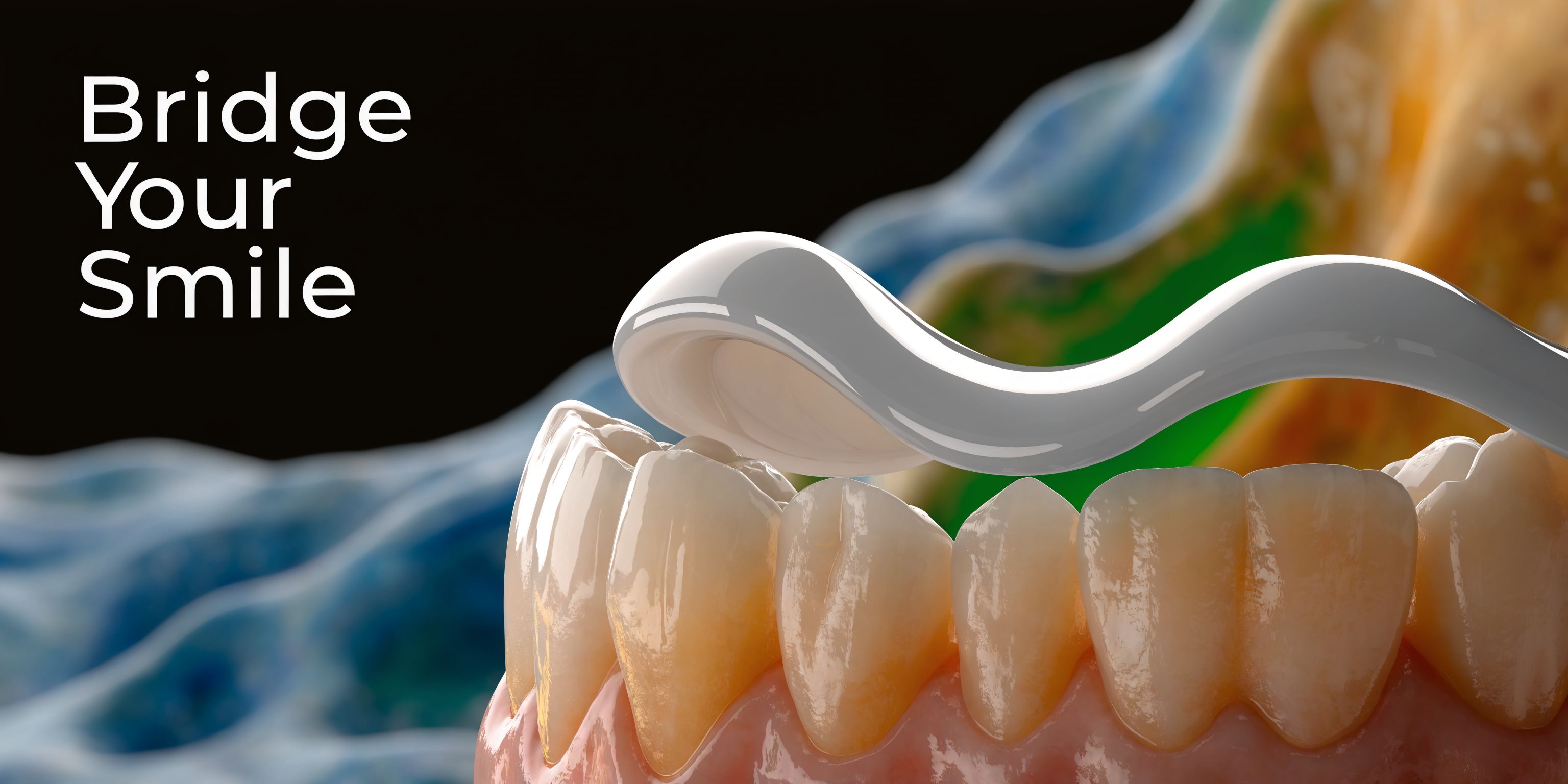 A close-up 3D render showing dental cream being applied to teeth to represent dental bridge care.