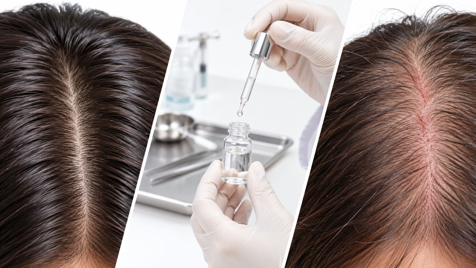 Hair Loss Treatment Side Effects: A Clinician's Safety Guide