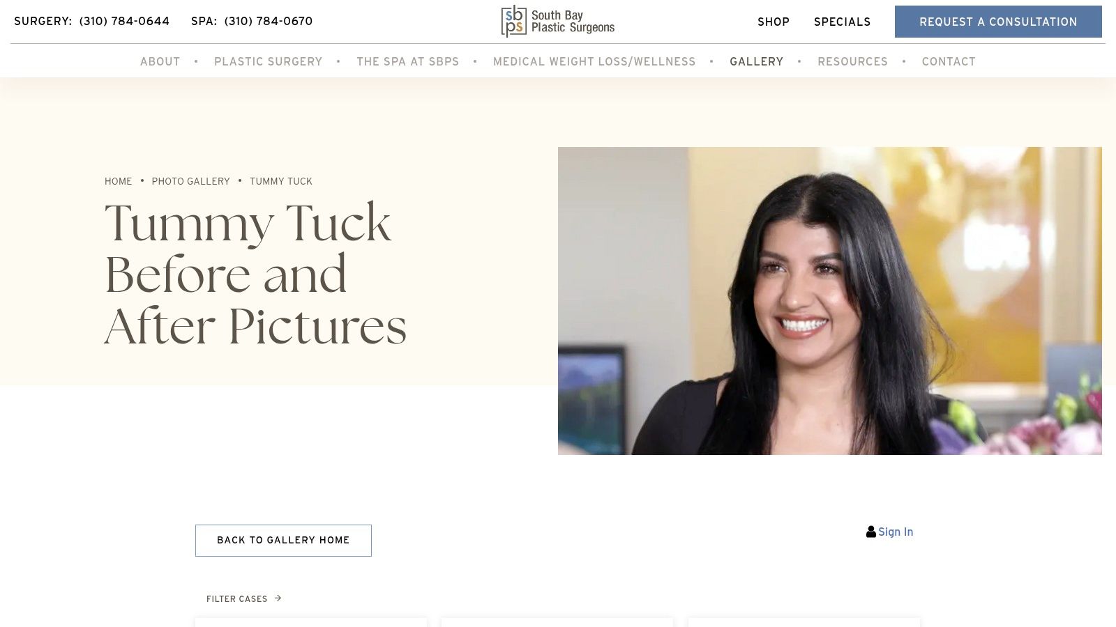 South Bay Plastic Surgeons – Tummy Tuck Photo Gallery (Torrance/Los Angeles South Bay)