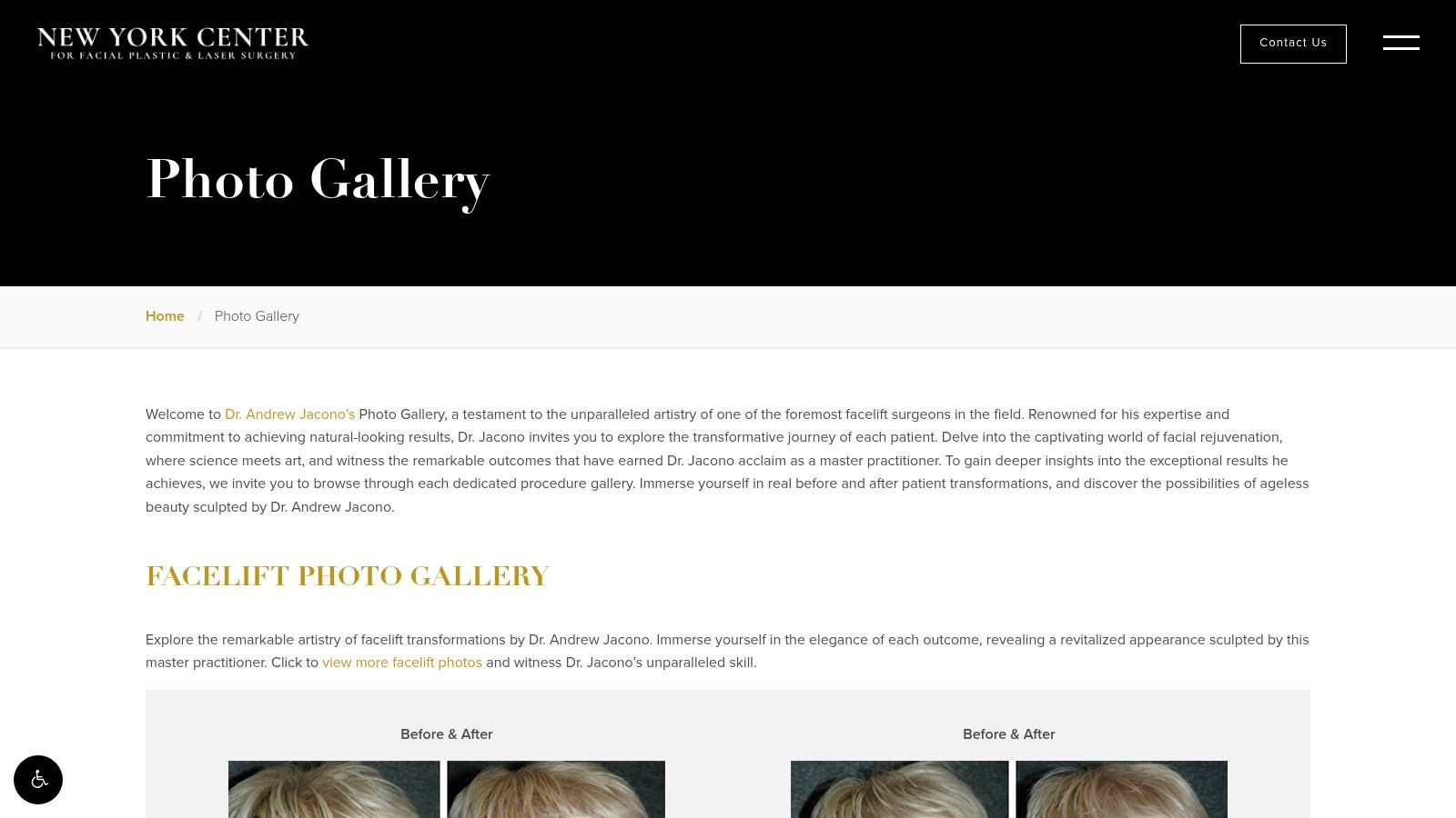 Andrew Jacono, MD – New York Center for Facial Plastic & Laser Surgery