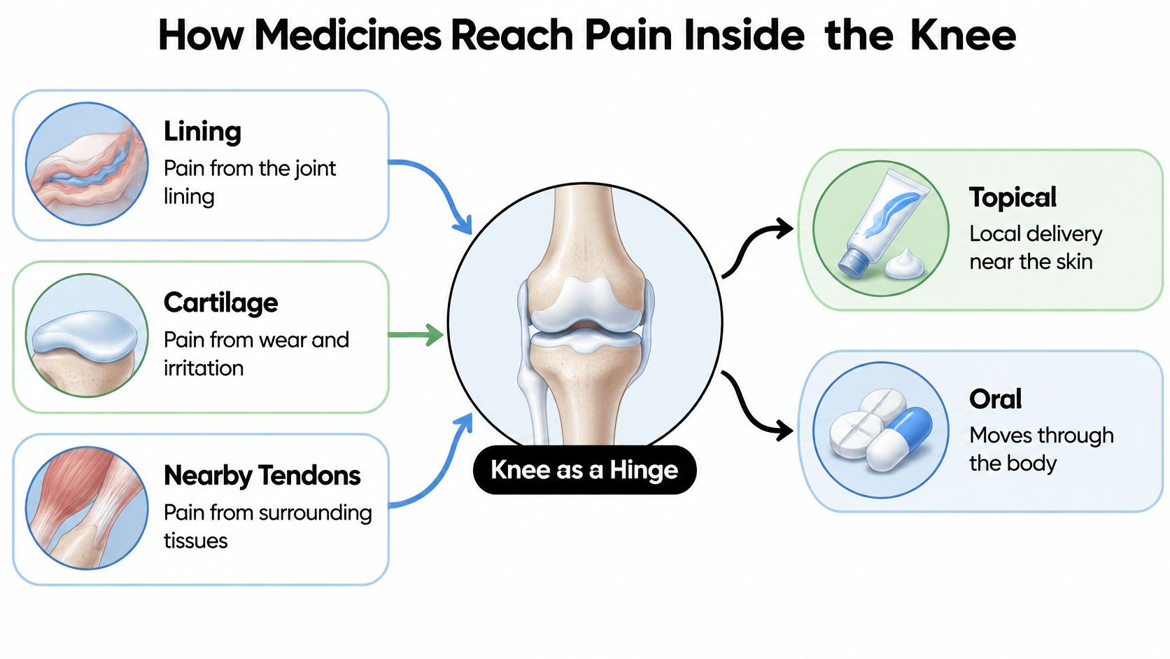 An infographic illustrating how topical and oral medications address different sources of knee pain.
