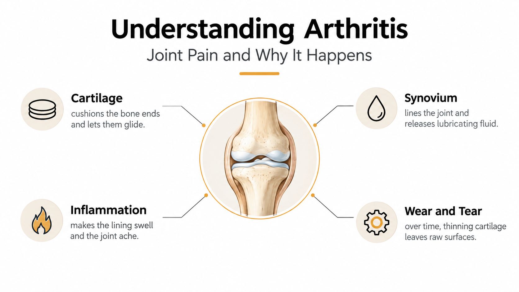 An infographic illustrating how arthritis impacts joints, featuring parts like cartilage, synovium, inflammation, and wear and tear.
