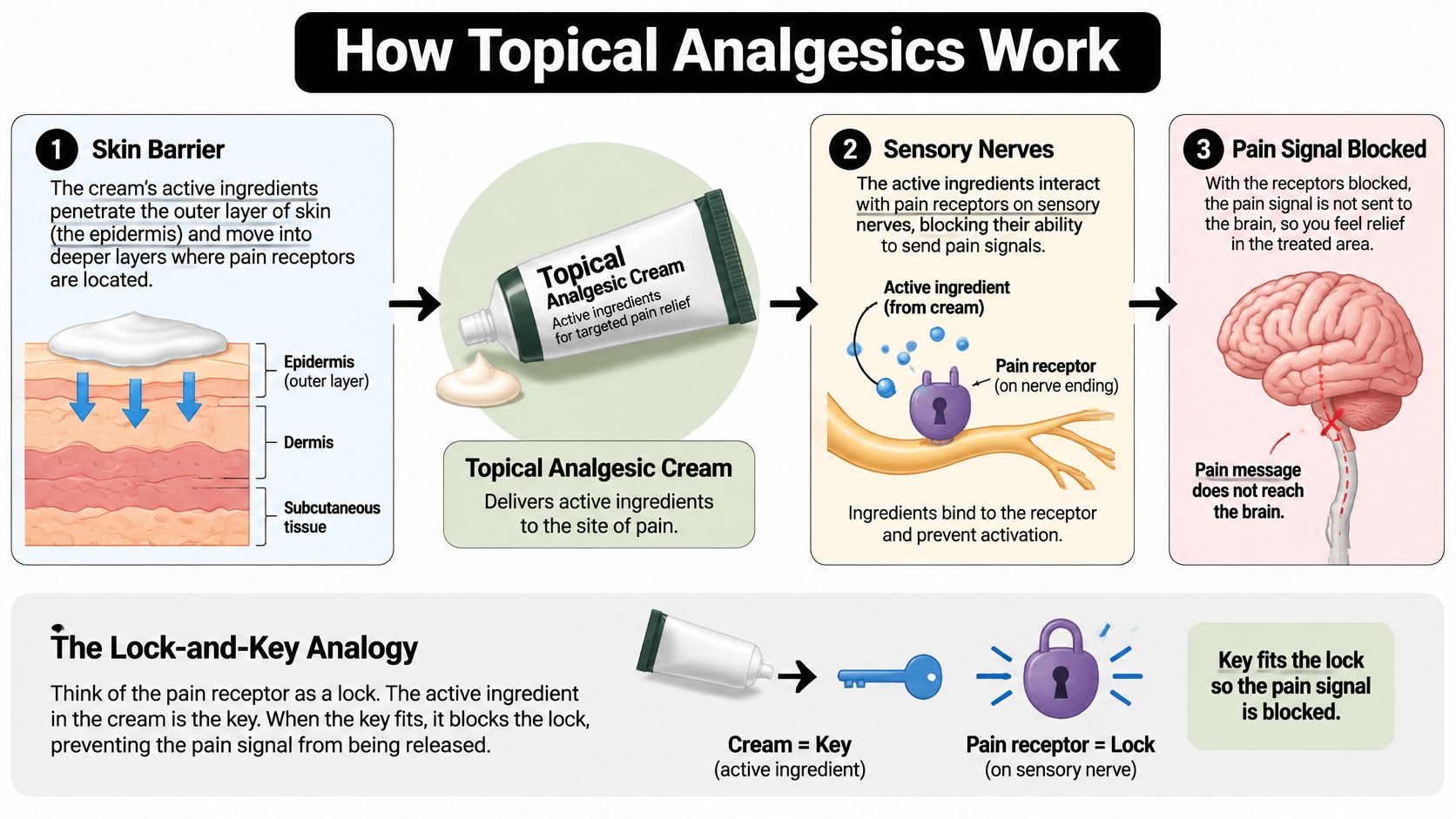 A diagram illustrating the step-by-step process of how topical analgesic cream works to block pain signals.