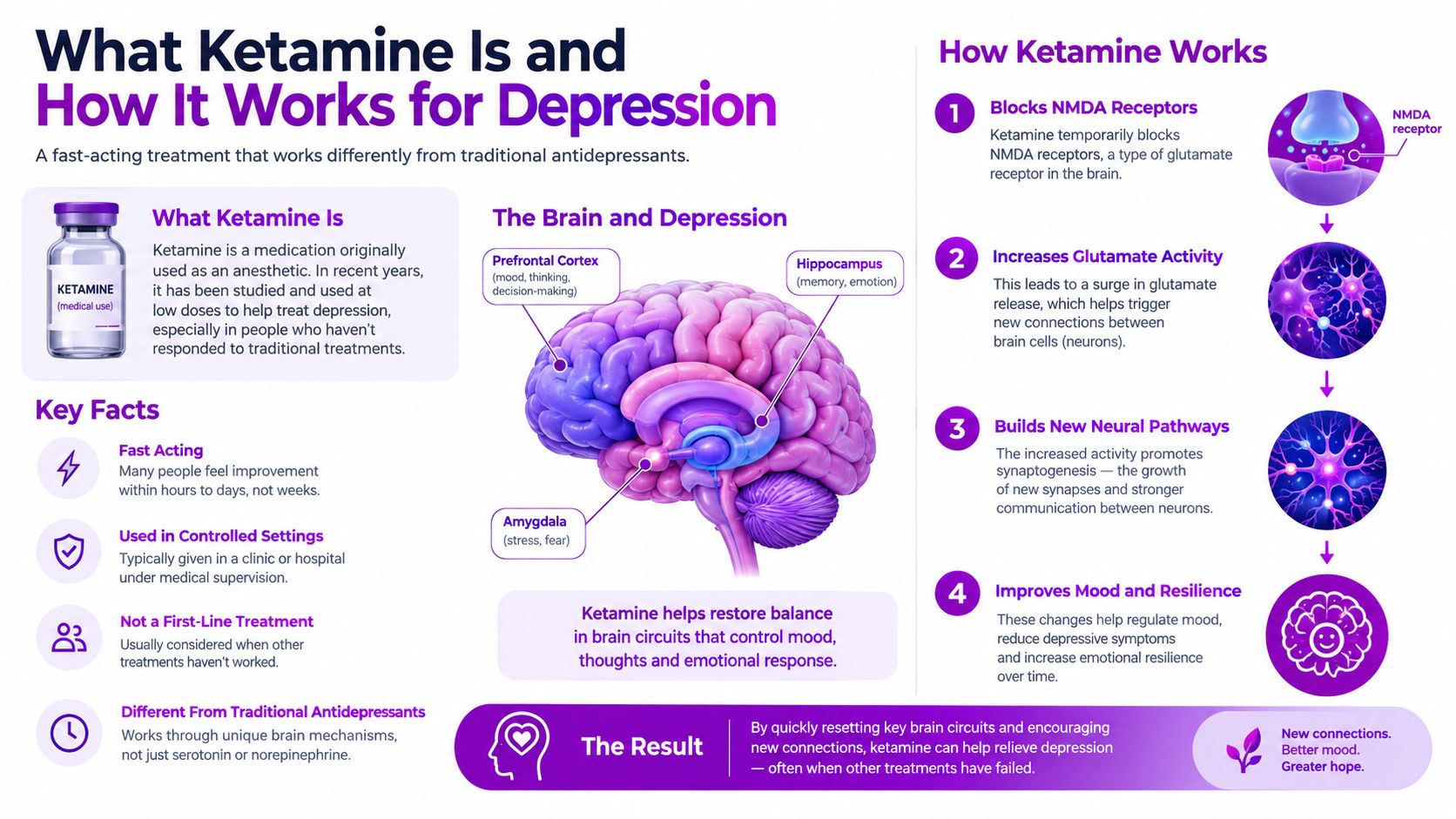 An infographic explaining how ketamine treatment works for depression, detailing brain mechanisms and therapy benefits.