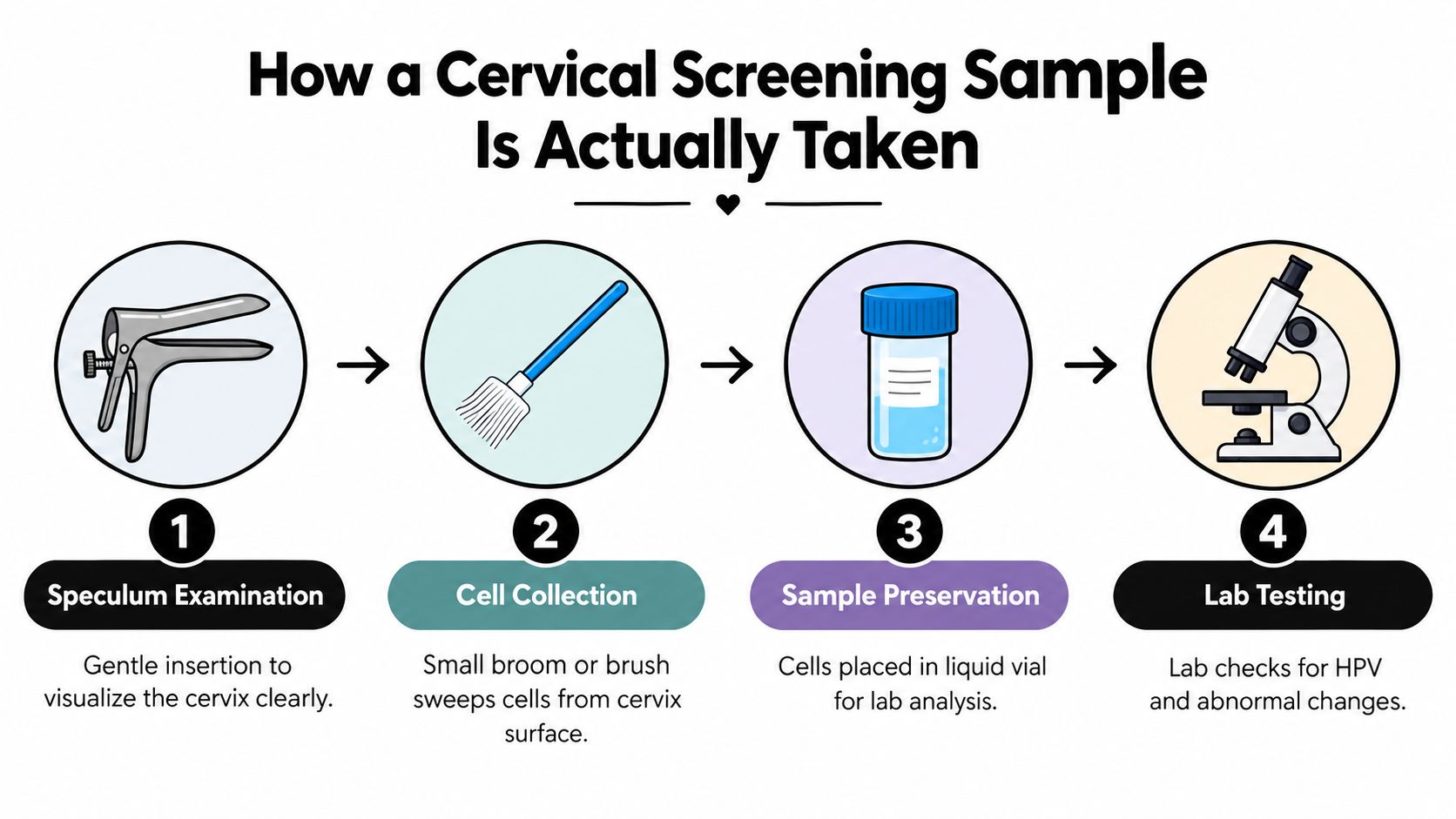 A four-step infographic illustrating the procedure for taking a cervical screening sample, from examination to laboratory testing.