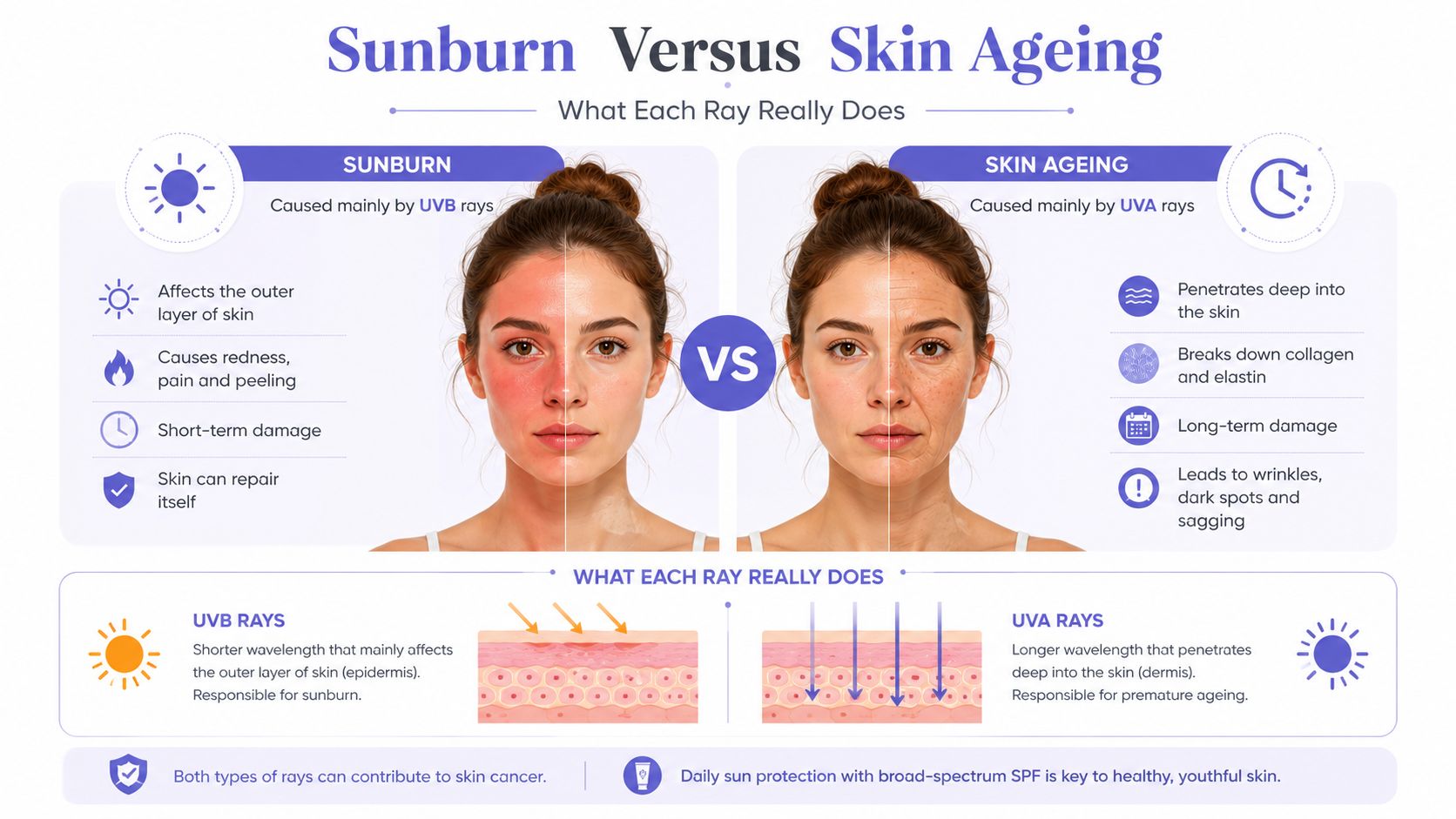 An infographic comparing the skin damage caused by UVB rays leading to sunburn and UVA rays causing aging.