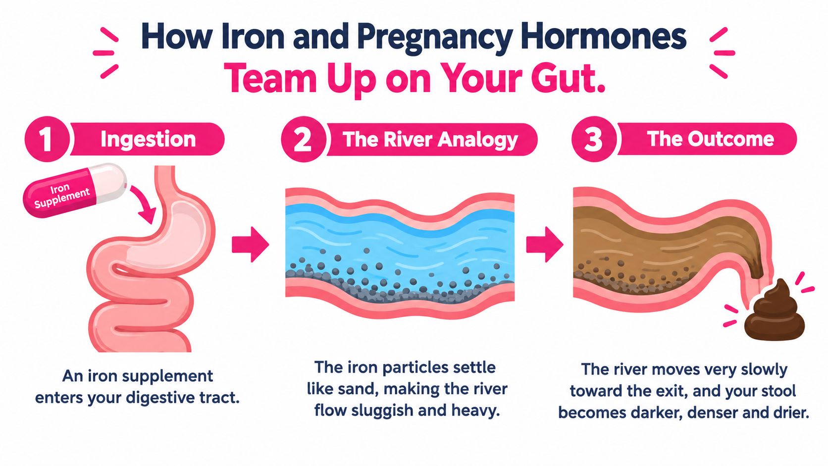 A diagram explaining how iron supplements and pregnancy hormones cause constipation using a river flow analogy.