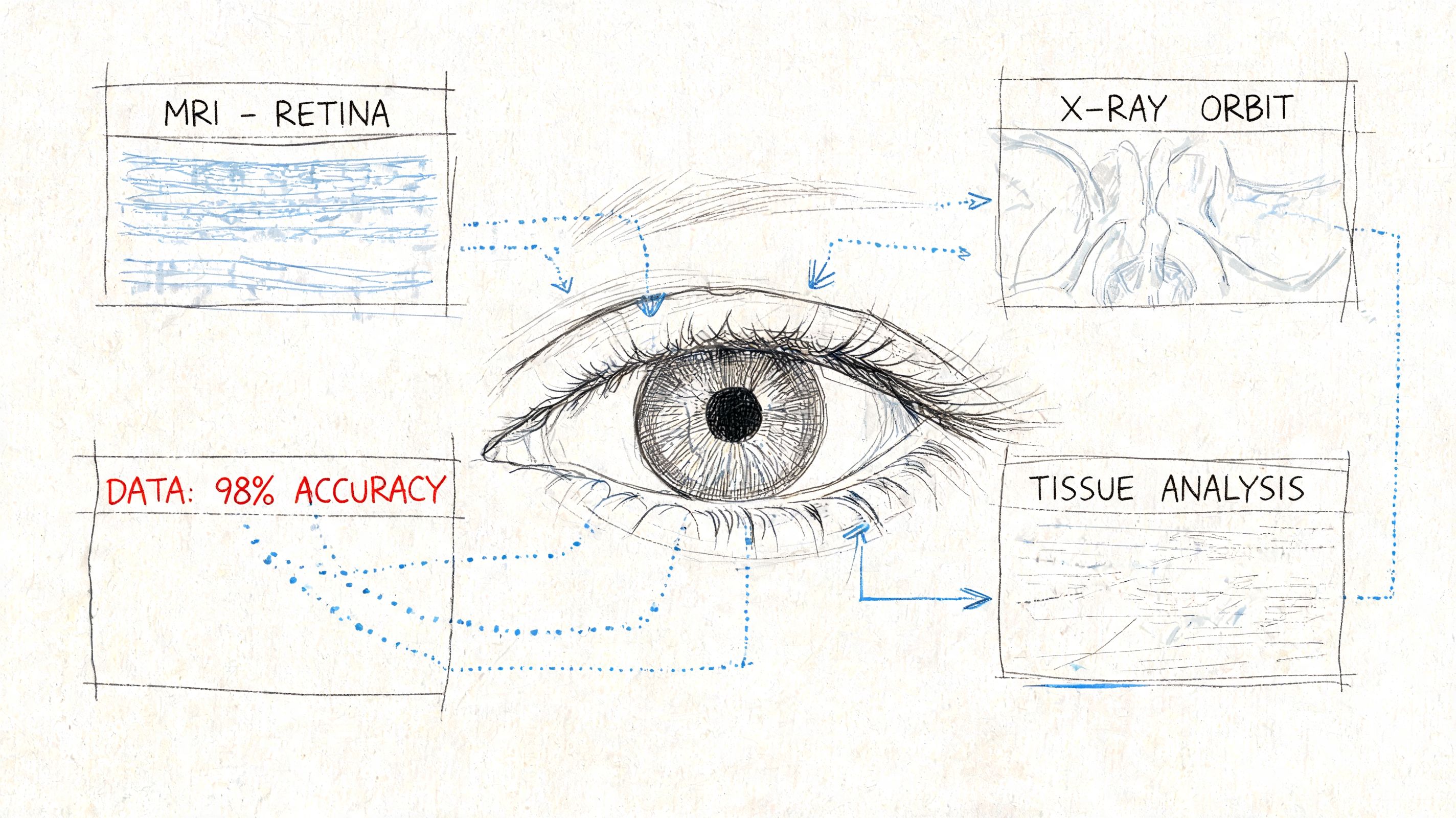 Boceto conceptual que ilustra la integración de visión por computador para diagnóstico ocular, imagen de retina y análisis de tejidos.