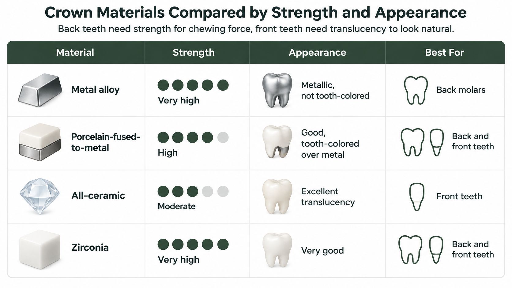 A chart comparing dental crown materials by their strength, appearance, and recommended usage for different teeth.
