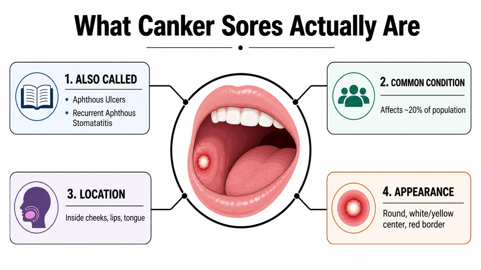 An educational infographic explaining that canker sores, also called aphthous ulcers, are common oral lesions.