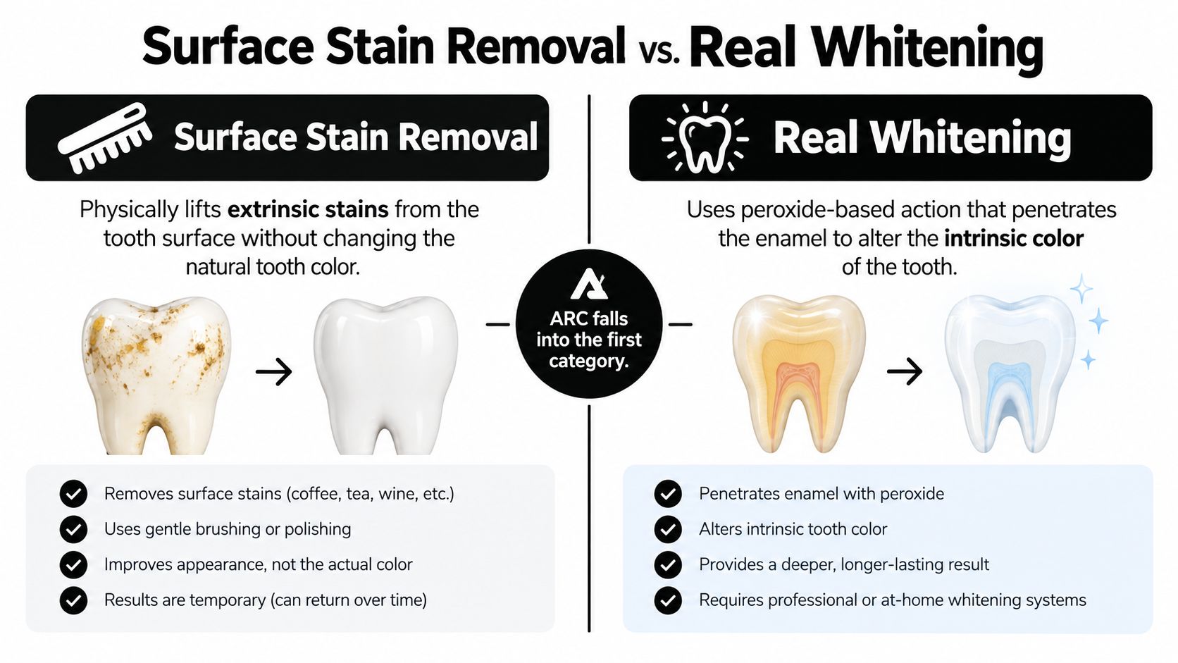 An infographic comparing surface stain removal versus real teeth whitening using illustrative diagrams and bullet points.