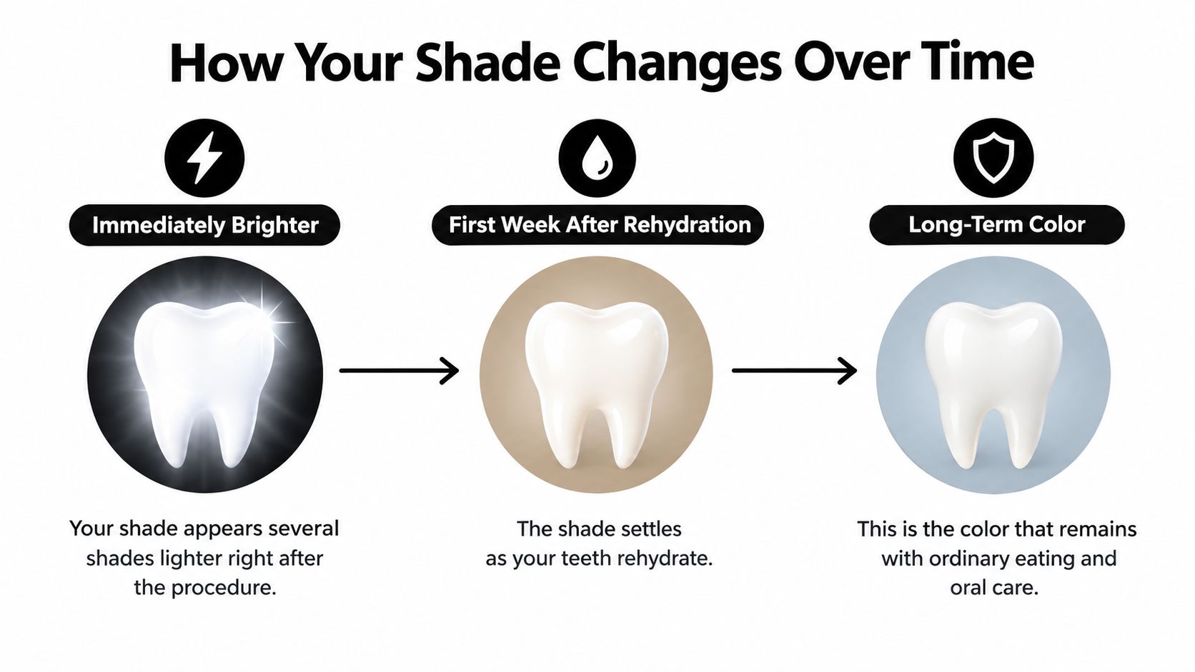 A diagram illustrating the progression of teeth whitening shade changes over time from immediate to long-term results.