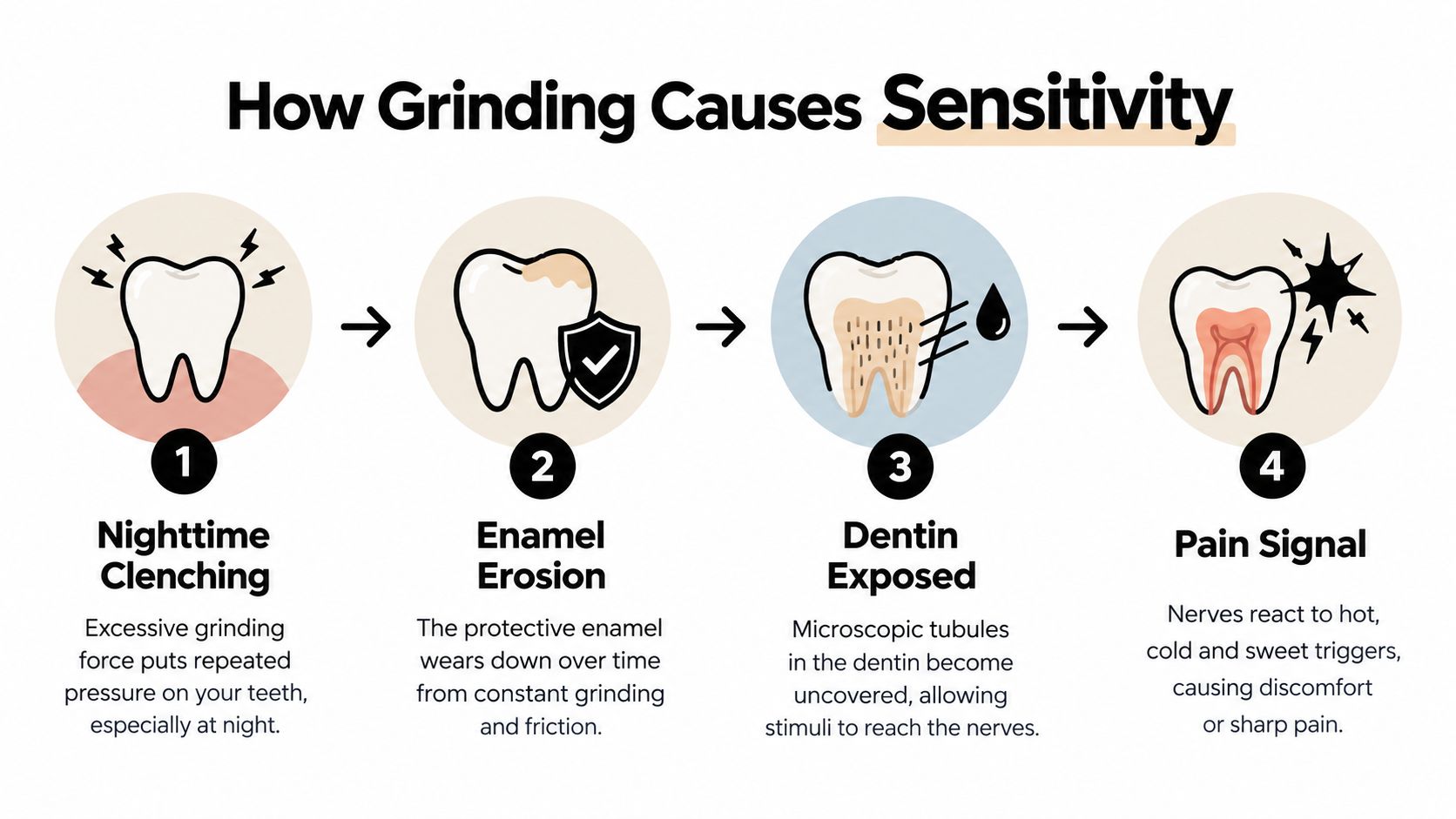 An infographic showing the four stages of how nighttime teeth grinding leads to dental sensitivity and pain.