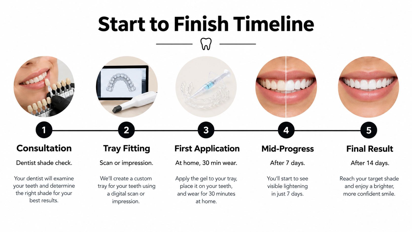 A five-step professional at-home teeth whitening process timeline from consultation to final bright smile results.