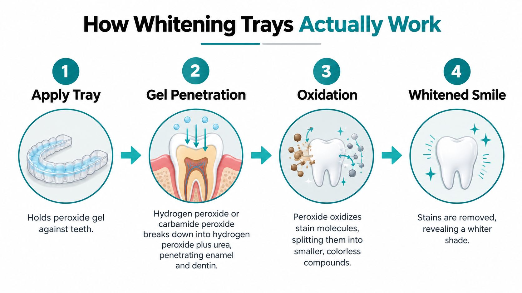 An infographic showing the four-step process of how teeth whitening trays work to remove dental stains.