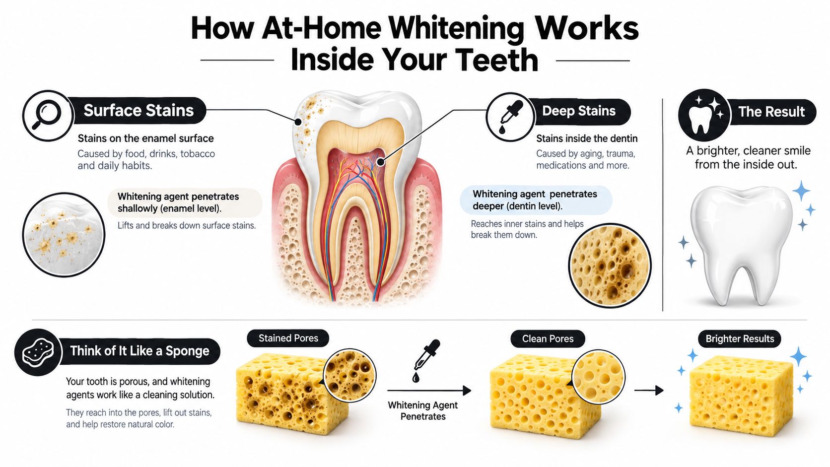 An infographic illustrating how at-home teeth whitening works by penetrating enamel and dentin layers to remove stains.