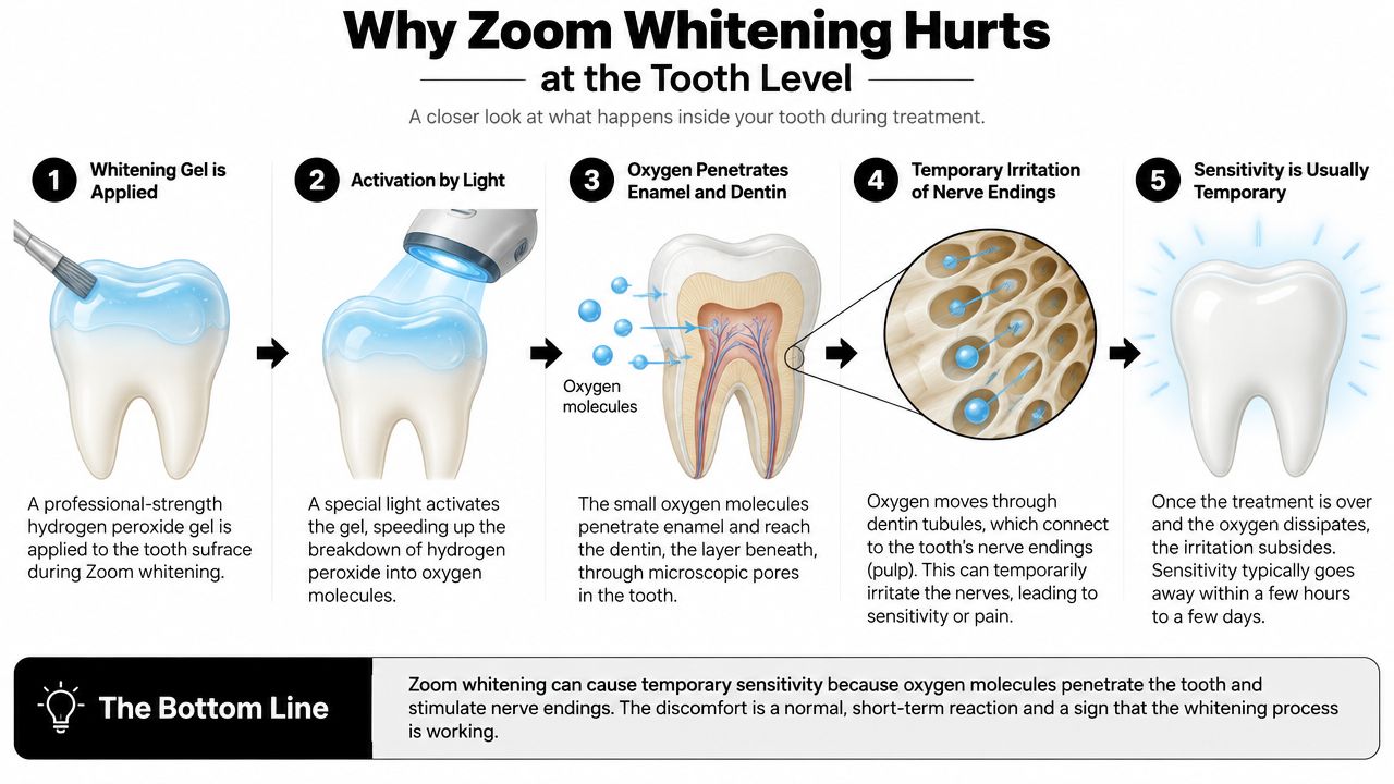 A diagram explaining why Zoom teeth whitening causes temporary sensitivity by showing how oxygen molecules penetrate teeth.
