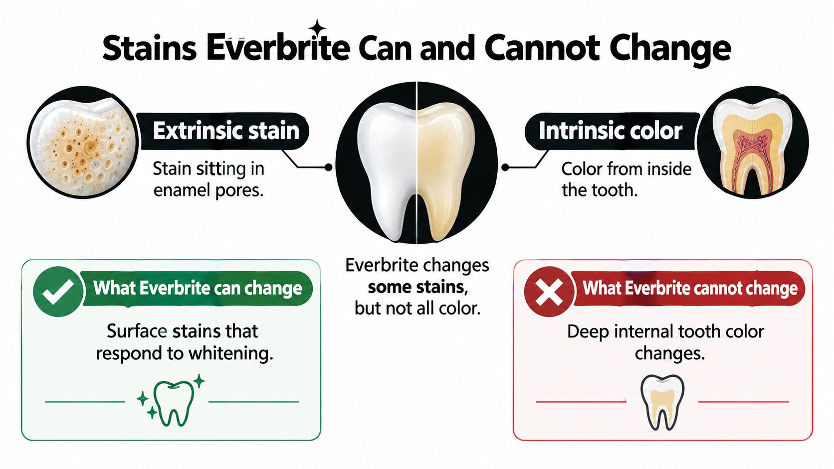 An infographic explaining that Everbrite removes extrinsic surface stains but cannot change deep intrinsic tooth color.