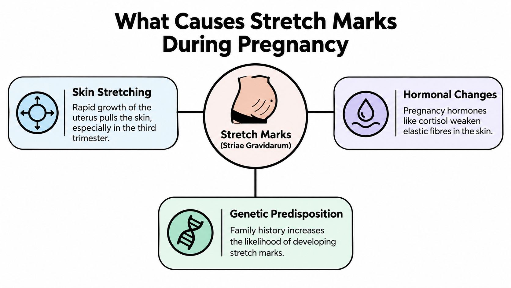 A diagram explaining the three primary causes of pregnancy-related stretch marks: skin stretching, hormonal changes, and genetics.