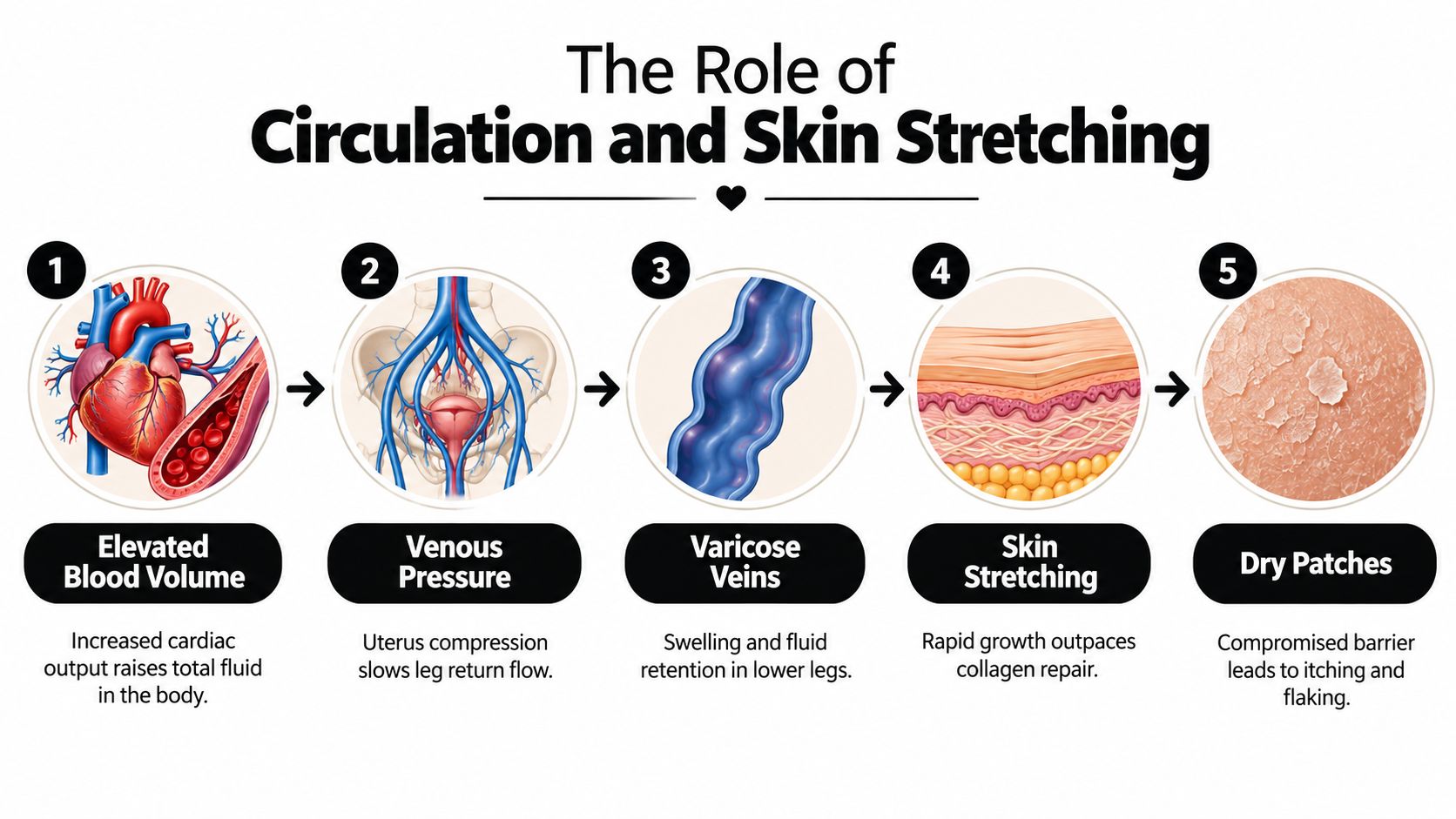 A diagram illustrating how pregnancy-related blood volume, venous pressure, and skin stretching cause dry patches on legs.