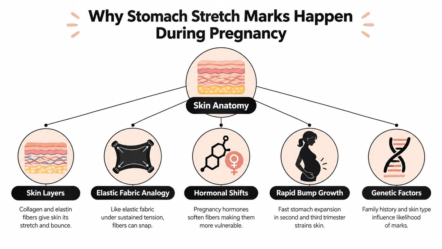 An infographic explaining the biological and physical causes of stomach stretch marks during pregnancy