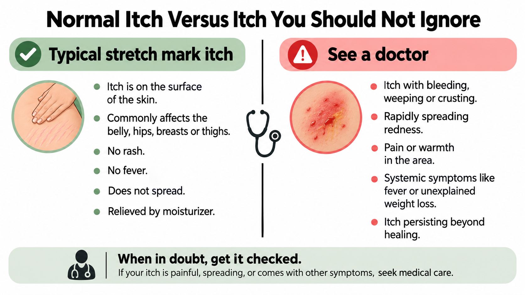 An infographic distinguishing between normal stretch mark itching and severe itching symptoms that require medical attention.