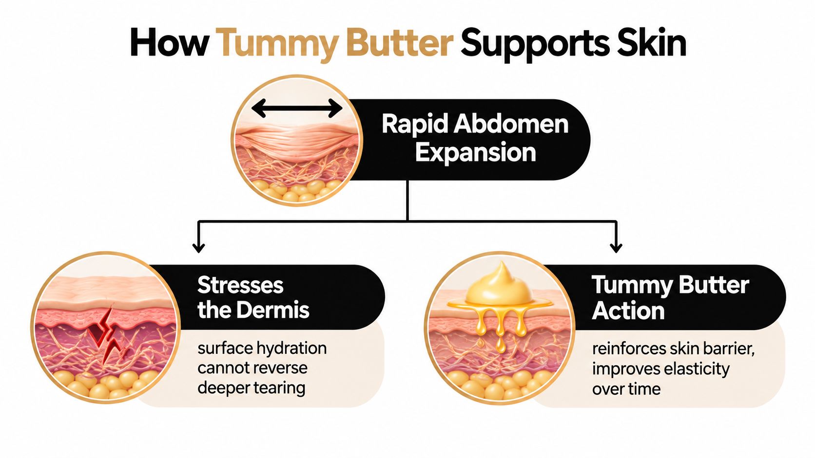 A diagram explaining how tummy butter improves skin elasticity and helps prevent deep tissue tearing during pregnancy.