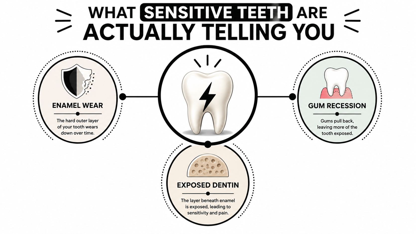 An infographic showing the three main causes of sensitive teeth: enamel wear, gum recession, and exposed dentin.