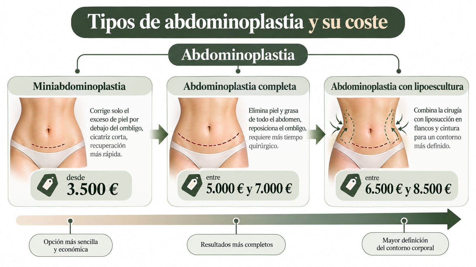 Infografía sobre los diferentes tipos de abdominoplastia, procedimientos quirúrgicos y su coste aproximado en euros.