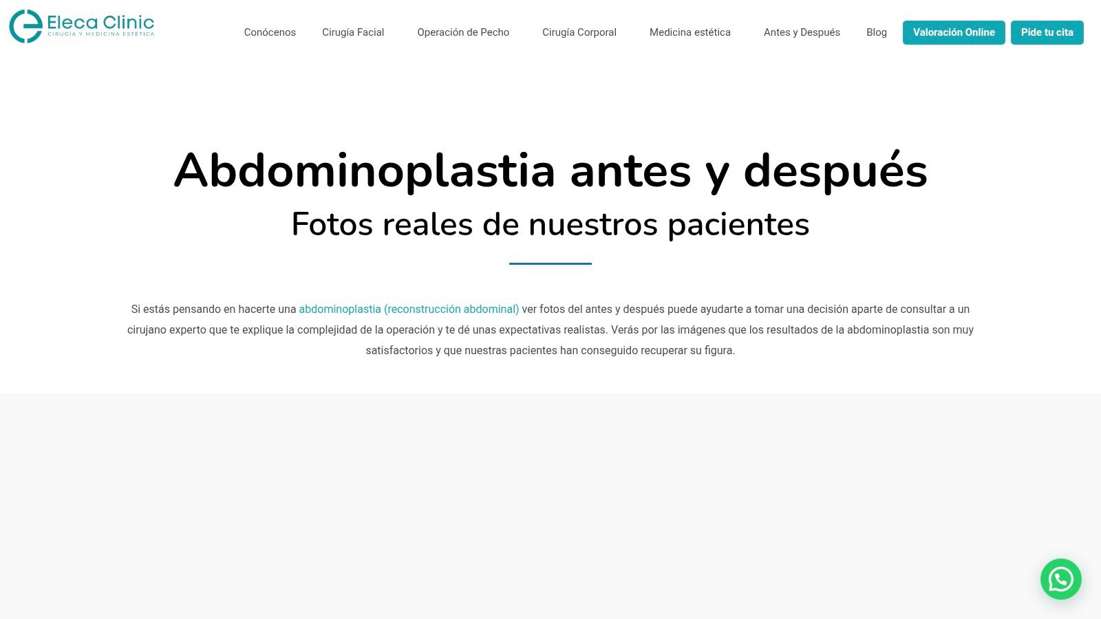 Eleca Clinic Madrid
