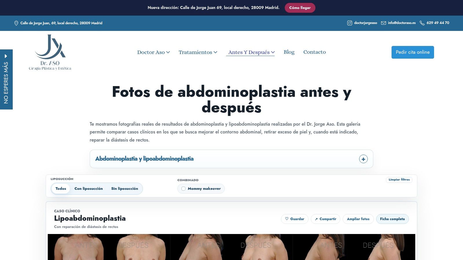 Clínica Dr. Jorge Aso Madrid