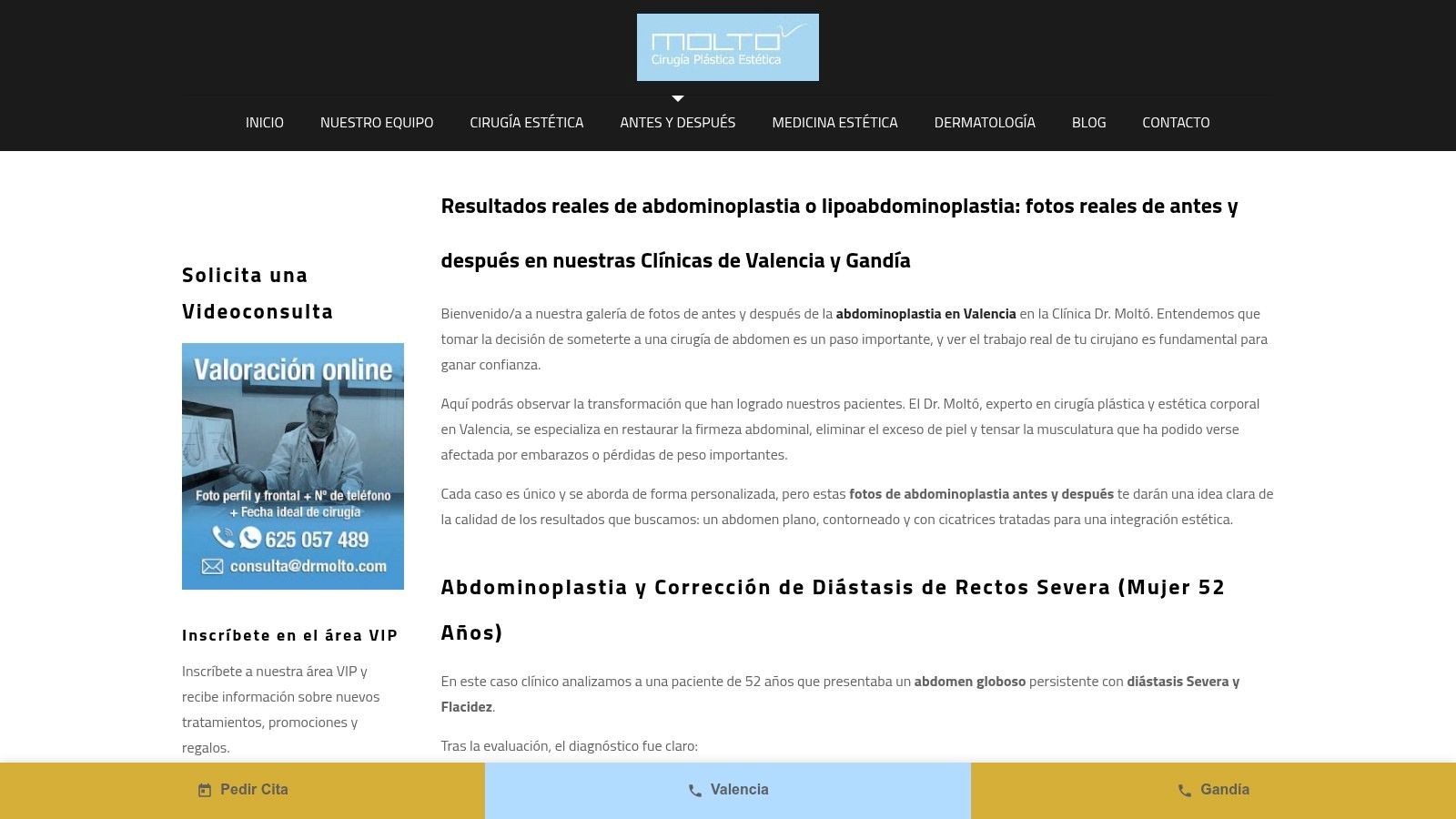 Clínica Dr. Moltó Valencia y Gandía