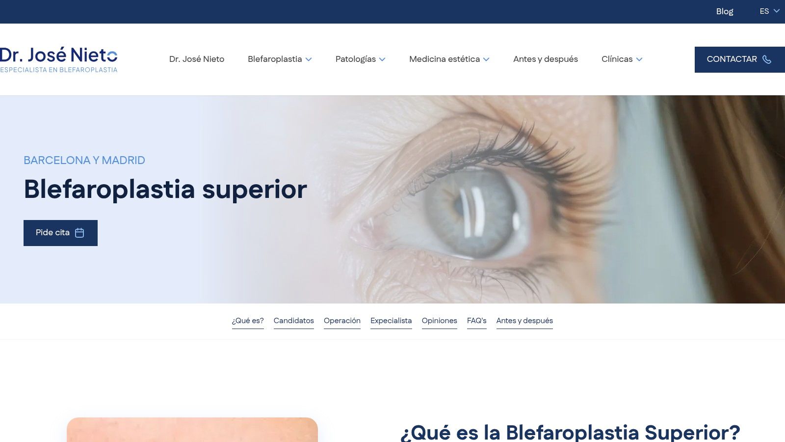Dr. José Nieto, Blefaroplastia.es