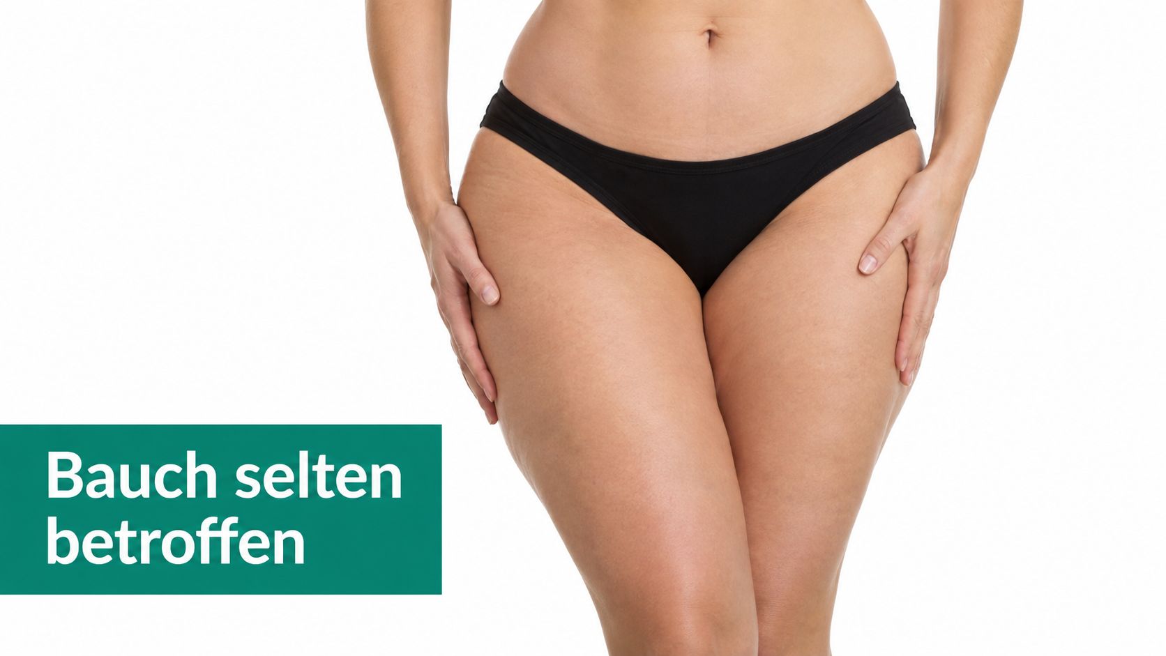 Eine Person trägt schwarze Unterwäsche, wobei der Fokus auf den Oberschenkeln liegt und der Bauchbereich selten betroffen ist.