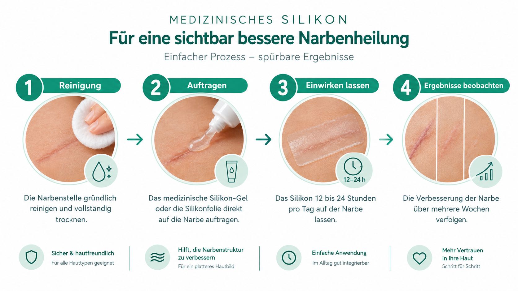 Infografik, die in drei Schritten zeigt, wie Silikon bei der Behandlung von Narben hilft, indem es die Kollagenproduktion reduziert.