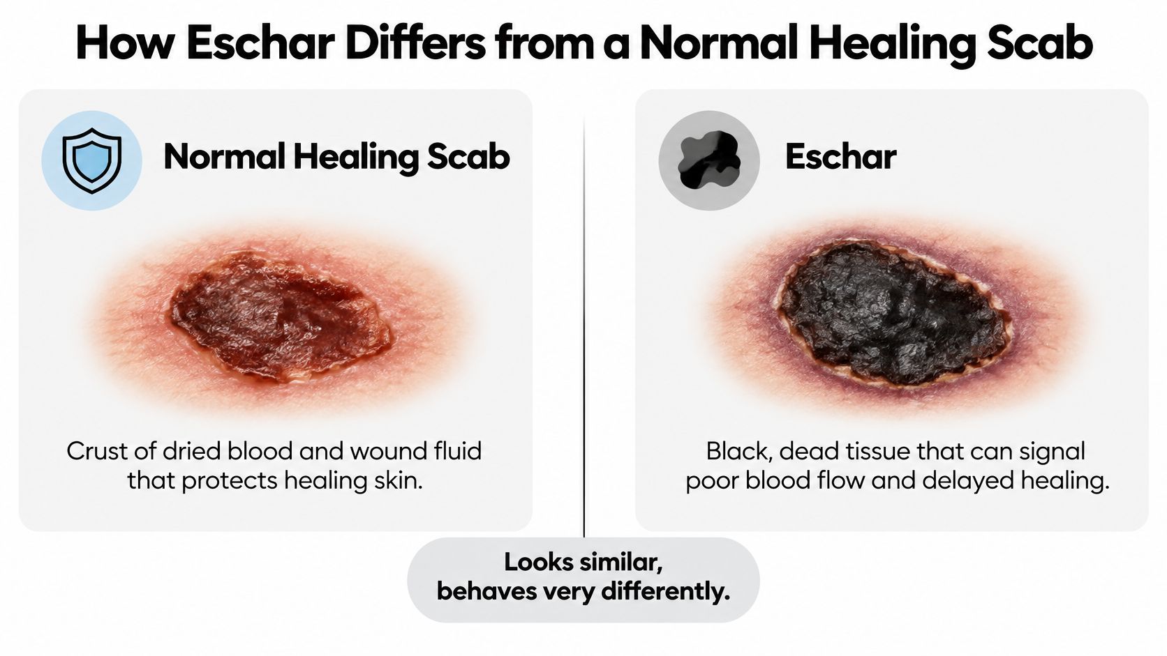 A comparison image showing the difference between a normal red healing scab and a black eschar wound.