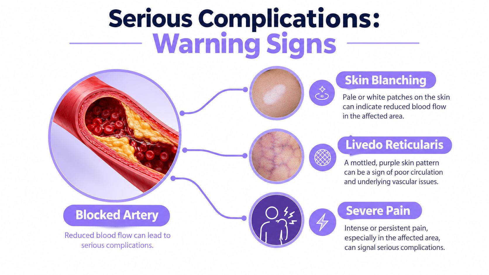 An infographic illustrating serious medical complications like skin blanching, livedo reticularis, and severe pain caused by blocked arteries.