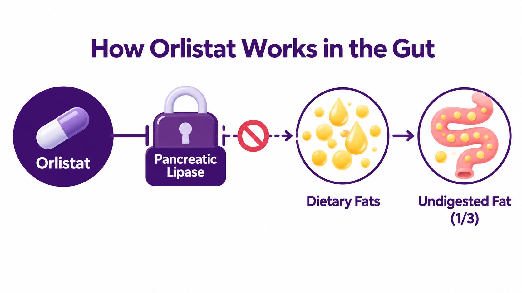 A diagram illustrating how Orlistat inhibits pancreatic lipase, preventing the breakdown of dietary fats in the gut.