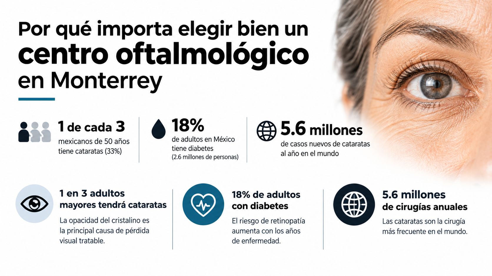 Infografía sobre la importancia de elegir un centro oftalmológico en Monterrey para tratar cataratas y diabetes.